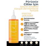 Novalyce Salisilik Asit Tonik Sivilce Ve Siyah Nokta Karşıtı, Gözenek Sıkılaştırıcı Salisilik Asit Yağlı ve Akneye Eğilimli Ciltler İçin - 8684985120094