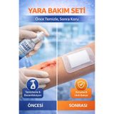 Octacare Esnek Steril (nonwoven) Yara Örtüsü 100 ml Antiseptik Sprey | Alkol İçermez, Hipoalerjenik