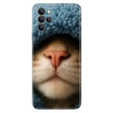 Omix Omix X700 ile Uyumlu Kılıf, Street Cat Temalı Desenli, Darbe Emici Silikon