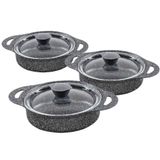 Oms Granit 3015 6 Parça Gri Alm Döküm Sahan Set