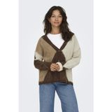 ONLY Noeme Life Jacquard V-Neck Kadın Triko Hırka – Jakarlı V Yaka Cardigan
