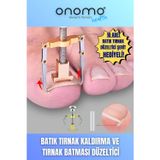 Onomo Health Batık Tırnak Düzeltici Batık Tırnak Çıkartıcı Aparat ve Batma Engelleyici Çubuk