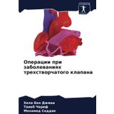 Operacii pri zabolewaniqh trehstworchatogo klapana: DE