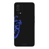 Oppo A55 4G İle Uyumlu Siyah Blue Heart Desenli Silikon Kılıf