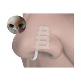 Ozcmax Burun Aparatı - Kafesli - Beyaz