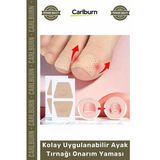 Özel Üretim Mantar Karşıtı Yenileyici Bakım Etkili Kolay Uygulanabilir Ayak Tırnağı Onarım Yaması