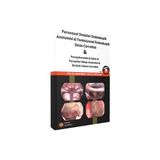 Paranazal Sinüsler Endoskopik Anatomisi Fonksiyonel Endoskopik Sinüs Cerrahisi