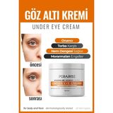 Perarise Göz Altı Torbası, Göz Çevresi Koyu Halka Morluk ve Gözaltı Bakım Kremi 30 ml - Beyaz