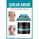Perarise Yumuşatıcı Ayak Beyazlatıcı 1 HAFTADA ETKİ! Topuk Çatlak Koku Giderici Nemlendirici Tırnak Bakım Kremi 100 ml
