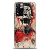 Phoenix Cep HD Baskılı Kılıf + SERAMİK TAM KAPLAYAN EKRAN KORUYUCU 5 Beyaz - Mor - Siyah Xiaomi Redmi Note 11 Pro Plus ile uyumlu