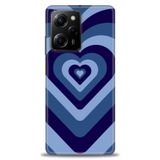 Phoenix Cep Kılıf HD Baskılı Kılıf + SERAMİK TAM KAPLAYAN EKRAN KORUYUCU 199 Beyaz Çicek Desenli Xiaomi Poco X5 Pro 5G ile uyumlu