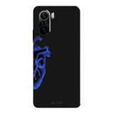 Poco F3 İle Uyumlu Siyah Blue Heart Desenli Silikon Kılıf