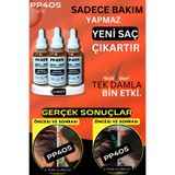 pp405 Profesyonel Saç Çıkartıcı Bakım Serumu - Kökü Oluşturucu ve Yoğun Gürleştirici 3 Adet