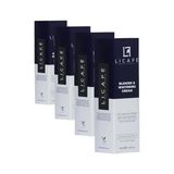 Prime Leke Kremi ve Cilt Beyazlatıcı Krem 40ML (4 Paketi) - Option-1