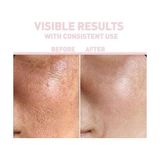 Prime Nıacınamıde%10 + Hyaluronıc Acıd%2 Serum