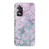 Printify Xiaomi Mi 10T Pro Kamera Korumalı Kapak Floral Pudra Tasarımlı Şeffaf Kılıf