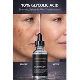 Puredermine %10 Glikolik Asit Serum – Gözenek Sıkılaştırıcı, Leke Karşıtı, Cilt Yenileyici AHA Peeling Serumu