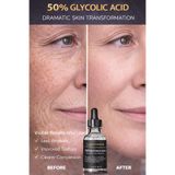 Puredermine %50 Glikolik Asit Peeling Serum – İleri Seviye Cilt Yenileme, Leke ve Kırışıklık Karşıtı