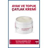 Quality Life Ayak ve Topuk Çatlak Bakım Kremi Nemlendirici Ayak Bakımı Kokusu Önleyici Giderici 100 ml Çatlağı