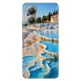 Realme Realme 12 Lite ile Uyumlu Kılıf, Pamukkale Temalı Desenli, Darbe Emici Silikon