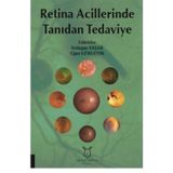 Retina Acillerinde Tanıdan Tedaviye - Kolektif