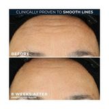 Roc Retinol Correxion Smoothing Kırışıklık Karşıtı Kapsül Serum 10 Adet