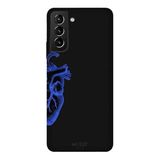 Samsung Galaxy S21 Plus İle Uyumlu Siyah Blue Heart Desenli Silikon Kılıf