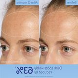 Şanal Koyu Lekeleri Aydınlatan Serum 50 ml