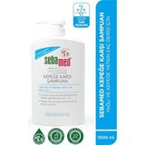 Sebamed 1000 ml Kepek Karşıtı Şampuan Yağlı Saçlar İçin Pirokton Olamin ile Etkili Bakım