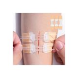 Seburem Yara Kapatma Şeridi Zip Strip Sütür Tek Dokumasız Ten Rengi 20 mm x 90 mm (Adet)