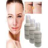 Semel White Factor For Instant Whitening Cilt Beyazlatıcı Renk Açıcı Bakım Kremi 120 ml Krem x 3 Ad - Belirtilmemiş