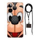Senada General Mobile Era 30 İle Uyumlu Kılıf Lc Mickeyyyyy Silikon İpli Boyun Askı Aparatlı