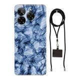 Senada General Mobile Era 50 İle Uyumlu Kılıf Desenli Blue Crystal Silikon İpli Boyun Askı Aparatlı