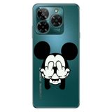 Senada General Mobile Era 50 İle Uyumlu Kılıf Telefon İle Uyumlu Kılıfı Era50 Baskılı Mickeyyyyy Karakter