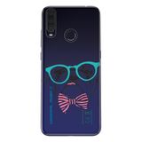 Senada General Mobile Gm 20 Pro İle Uyumlu Kılıf 0.4Mm Lazer Kesim Silikon Kapak Dr.Pug