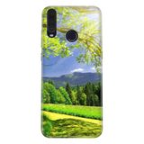 Senada General Mobile Gm 20 Pro İle Uyumlu Kılıf 0.4Mm Lazer Kesim Silikon Kapak Mis Oksijen