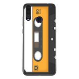 Senada General Mobile Gm 20 Pro İle Uyumlu Kılıf 0.4Mm Lazer Kesim Silikon Kapak Muzik Kaset