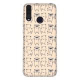 Senada General Mobile Gm 20 Pro İle Uyumlu Kılıf 0.4Mm Lazer Kesim Silikon Kapak Pug