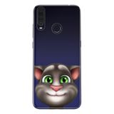 Senada General Mobile Gm 20 Pro İle Uyumlu Kılıf 0.4Mm Lazer Kesim Silikon Kapak Tom