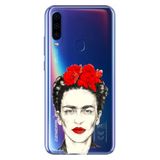 Senada General Mobile Gm 20 Pro İle Uyumlu Kılıf Silikon Desenli Tam Koruma Resimli Xfridax