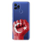 Senada General Mobile Gm 21 İle Uyumlu Kılıf 0.4Mm Lazer Kesim Silikon Kapak Tc