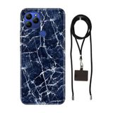 Senada General Mobile Gm 21 İle Uyumlu Kılıf Dark Blue Desenli Silikon İpli Boyun Askı Aparatı