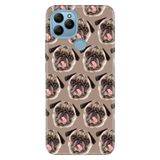 Senada General Mobile Gm 21 İle Uyumlu Kılıf Silikon Desenli Tam Koruma Resimli Pug Pug Köpek