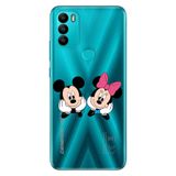 Senada General Mobile Gm 21 Plus İle Uyumlu Kılıf Silikon Desenli Tam Koruma Resimli Minnie Mickeyyyyy
