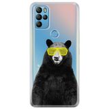 Senada General Mobile Gm 21 Pro İle Uyumlu Kılıf 0.4Mm Lazer Kesim Silikon Kapak Kanye Bear