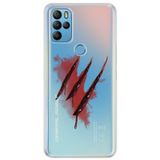 Senada General Mobile Gm 21 Pro İle Uyumlu Kılıf 0.4Mm Lazer Kesim Silikon Kapak Keskin Yara