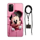 Senada General Mobile Gm 21 Pro İle Uyumlu Kılıf Mickeyyyyy Desenli Silikon İpli Boyun Askı Aparatı