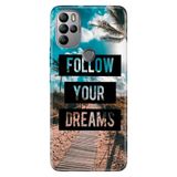 Senada General Mobile Gm 21 Pro İle Uyumlu Kılıf Silikon Desenli Tam Koruma Resimli Follow Your Dreams