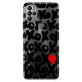 Senada General Mobile Gm 21 Pro İle Uyumlu Kılıf Silikon Desenli Tam Koruma Resimli Xoxo