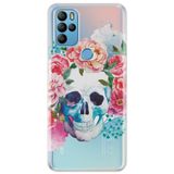 Senada General Mobile Gm 21 Pro Uyumlu İle Uyumlu Kılıf 0.4Mm Lazer Kesim Silikon Kapak Iskelet Vip